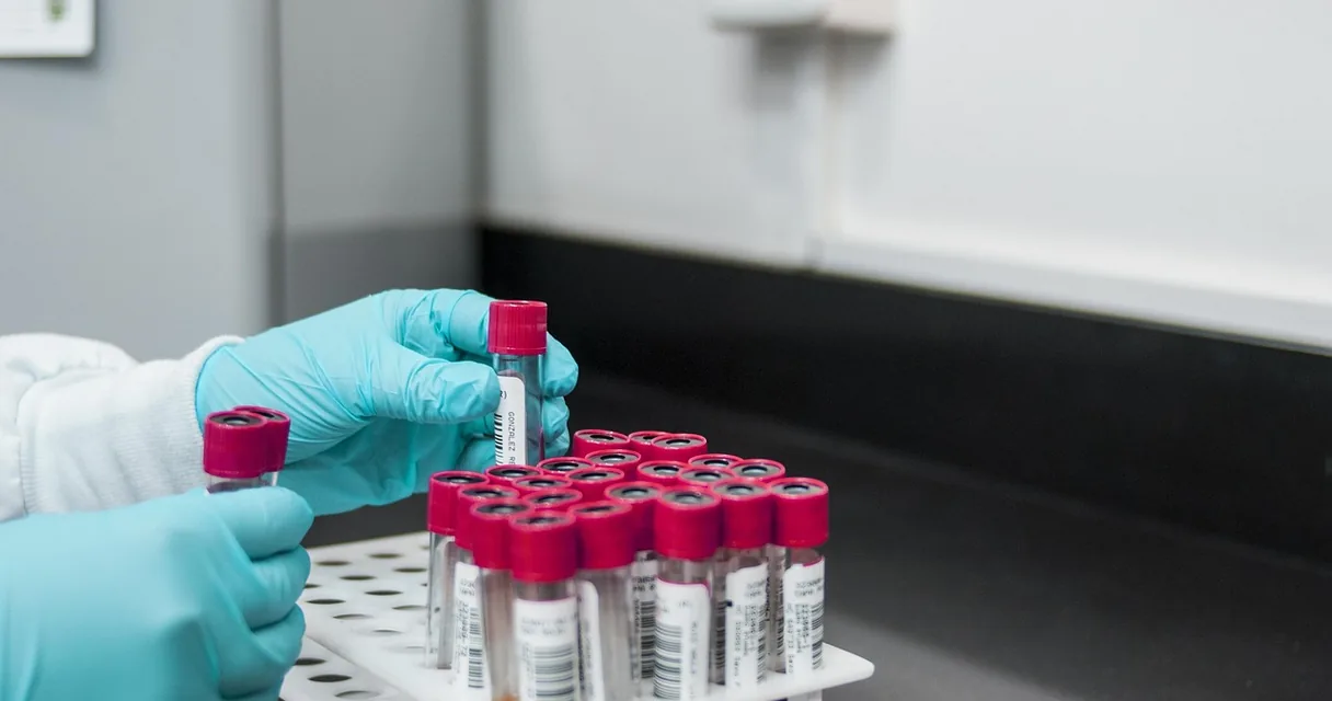 Quanto Tempo o Álcool Leva para Sair do Corpo e do Sangue